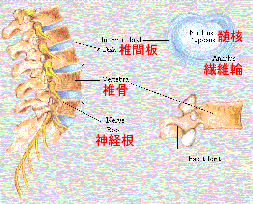 図（腰椎）-椎間板ヘルニア
